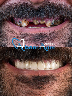 Dr. Abeer Adel | The best dentist in Egypt